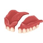 broken denture, time to replace your denture