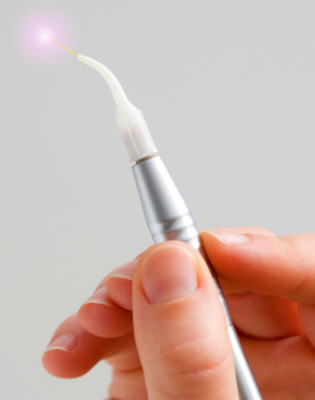 image of dental tool