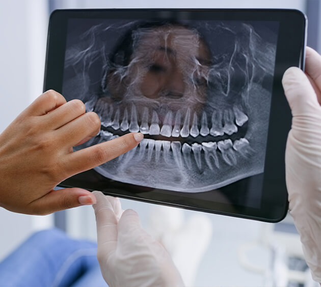 hand pointing at dental x-ray