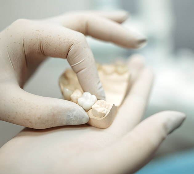 a hand holding dental model
